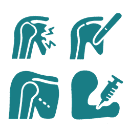 Shoulder Elbow and Upper Limb Surgeries