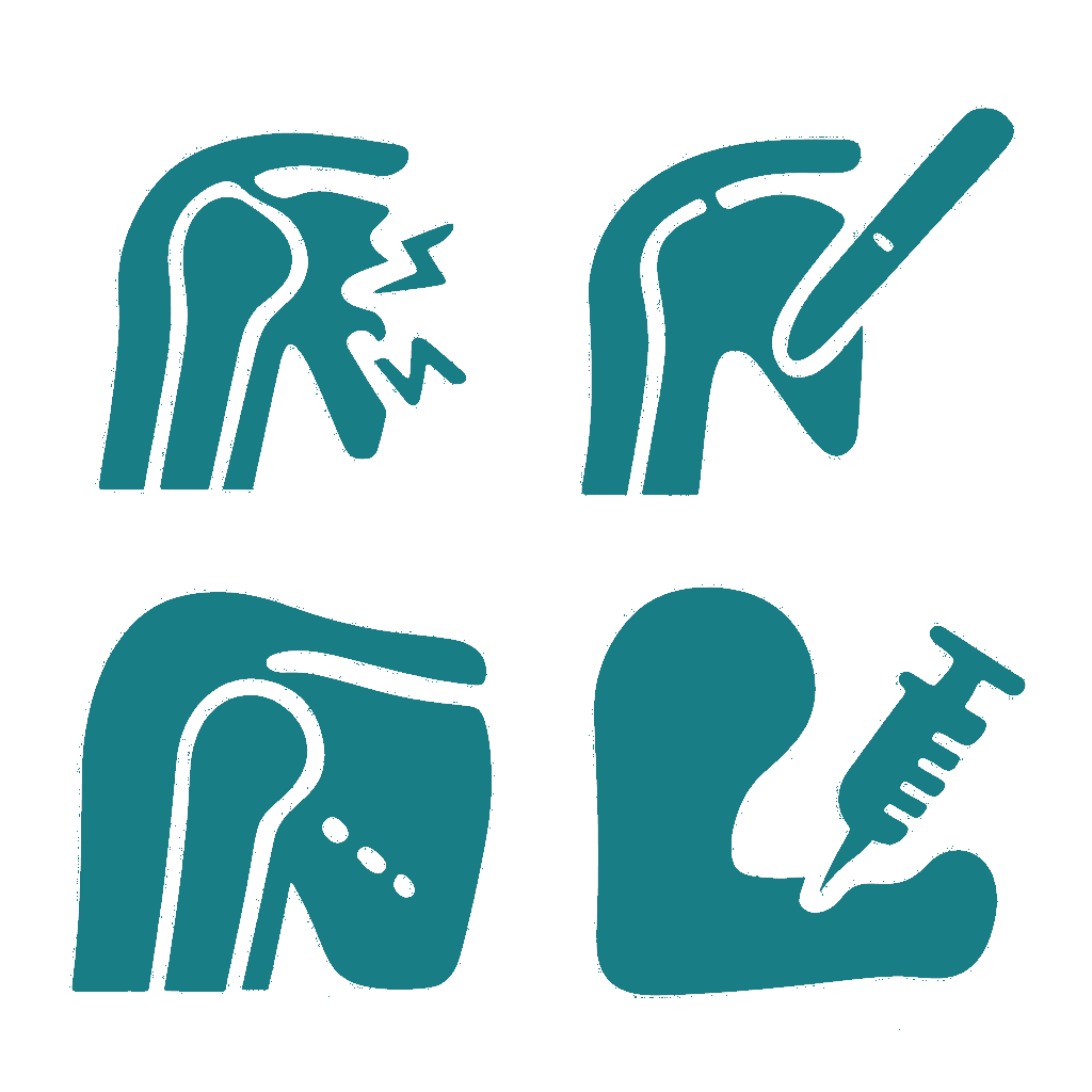 Shoulder Elbow & Upper Limb